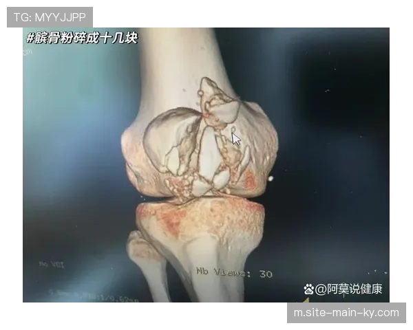 勇士官方确认柯瑞退出全明星 右膝髌骨疼痛康复慢于预期 勇士官方确认柯瑞退出全明星 右膝髌骨疼痛康复慢于预期